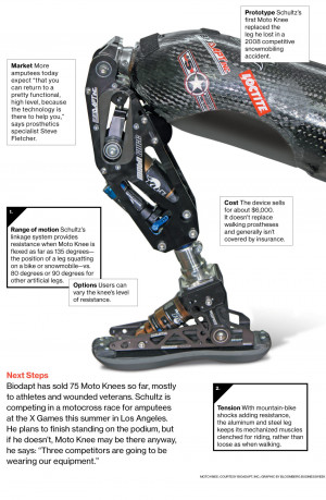 Innovation: Moto Knee, a Prosthesis for Extreme Athletes