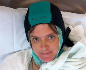 Cold caps may help cancer patients keep their hair