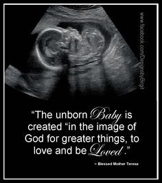 prolife unborn child unborn baby quotes pregnancy baby