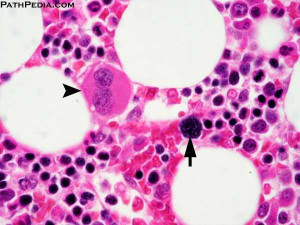 bone marrow histology
