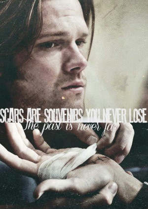 Unless your raised from perdition by an angel then your scars are gone ...