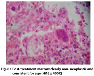 normal vs abnormal bone marrow