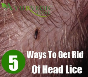 how do you get rid of head lice