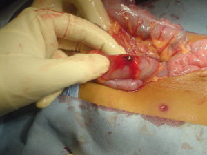 Air Pellet Gun Wounds