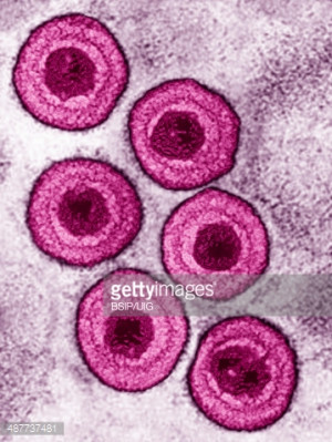 Varicella Zoster Virus Microscope