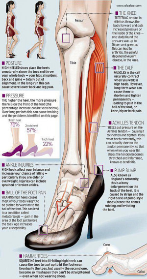 Health Tips-High Heeled Shoes Problems-Leg Pain