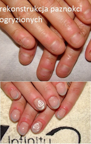 Manicure Pedicure Paznokcie Hybrydowe Paznokcie Elowe Zgierz