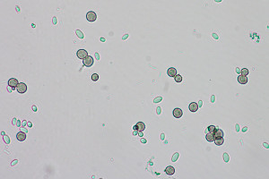 Amoeba Microscope Slide...