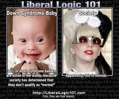 Hi!! So I'm pinning this because my little brother has Down Syndrome ...