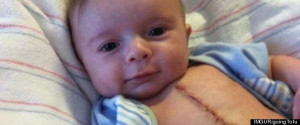 ... Surgery Baby: Little Joey Captures Hearts After Open-Heart Surgery