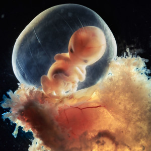 ... Photographs of the foetus developing in the womb, by Lennart Nilsson
