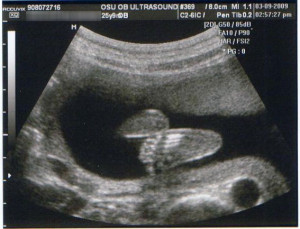 Funny Baby Ultrasound