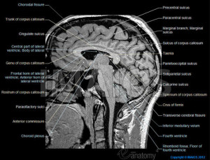 MRI-of-the-brain-sagittal-slice-en_medical512.jpg