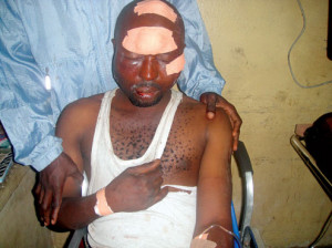 â€¢One of the LASTMA officials battered by soldiers.