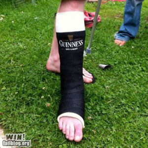 funny broken leg images