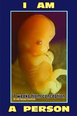 NO A LA REPARTICIÓN DE ABORTIVOS CON NUESTROS RECURSOS (impuestos ...