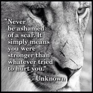 Don't be ashamed of your scars