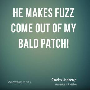 Charles Lindbergh - He makes fuzz come out of my bald patch!