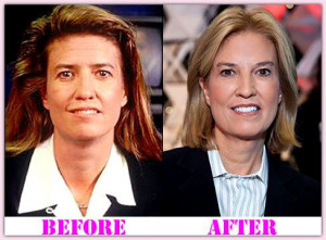 facial plastic surgery before and after