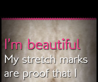 stretch mark meme