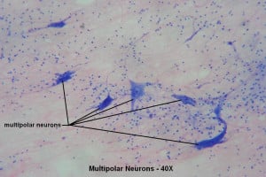 Multipolar Neuron Pictures
