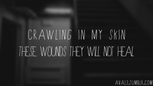 ... white, craw, crawling, heal, linkin park, lyrics, music, quote, ski