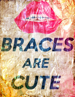 Braces are cute by xSofiaAlexandra