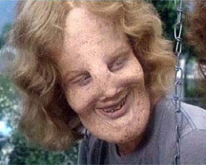 An Ode to Rocky Dennis