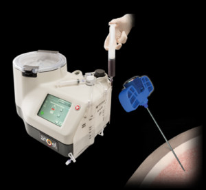 Bone marrow concentration 0 large