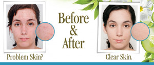 Individual results will vary depending on number of treatments, skin ...