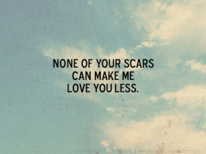 None of your scars can make me love you less.