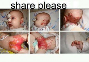 This is what childhood cancer looks like.... period.....
