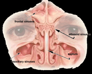 Home Remedies for Sinus Pressure Relief: