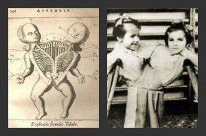 Images For Josef Mengele Experiments... More