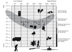 Different Types Hearing Loss