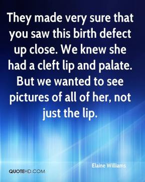 ... palate. But we wanted to see pictures of all of her, not just the lip