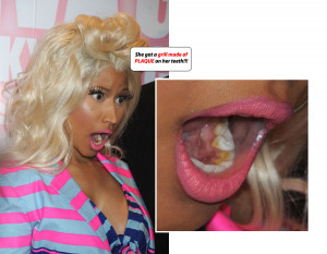 Nicki Minaj 's teeth ? Are they real or fake? Watching some Nicki ...