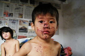 Child Abuse In Ningbo Anger Chinese Netizens (NSFW) – chinaSMACK