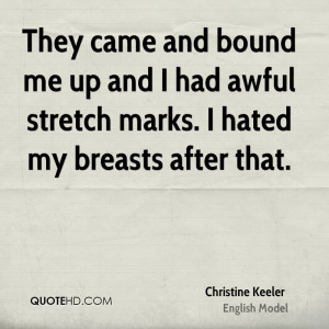 ... me up and I had awful stretch marks. I hated my breasts after that