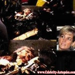 Princess Diana Autopsy Picture (celebrity-autopsy.com)