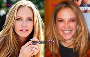 Ally Walker Before And...