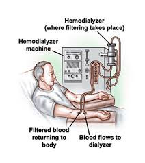 Polycystic Kidney Disease and Dialysis