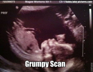 Funny Grumpy Cat Baby Scan Ultrasound Picture