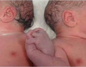 Twins holding hands after birth