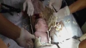 Newborn Baby Rescued From Toilet Pipe in China