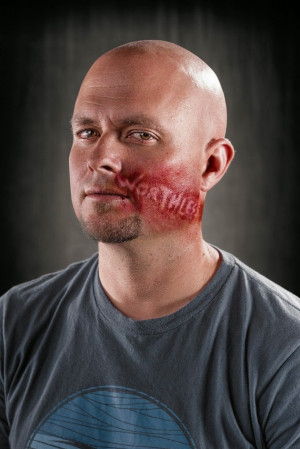 ... -Abuse Photographs that Painfully Depicts the Victims of Verbal Abuse