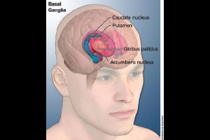 Tourette syndrome Picture Slideshow