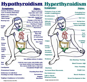... , Hashimotos S Hypothyroidism, Health News, Hypothyroidism Symptoms
