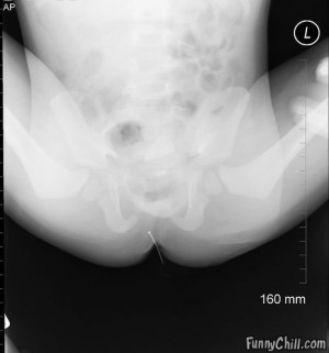 Pictures of crazy, weird and painfully looking x-rays.
