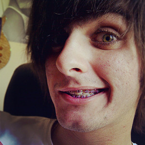 berryandrew:I finally got pink braces!